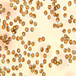 Ustilaginoidea virens spores from infected rice grain
